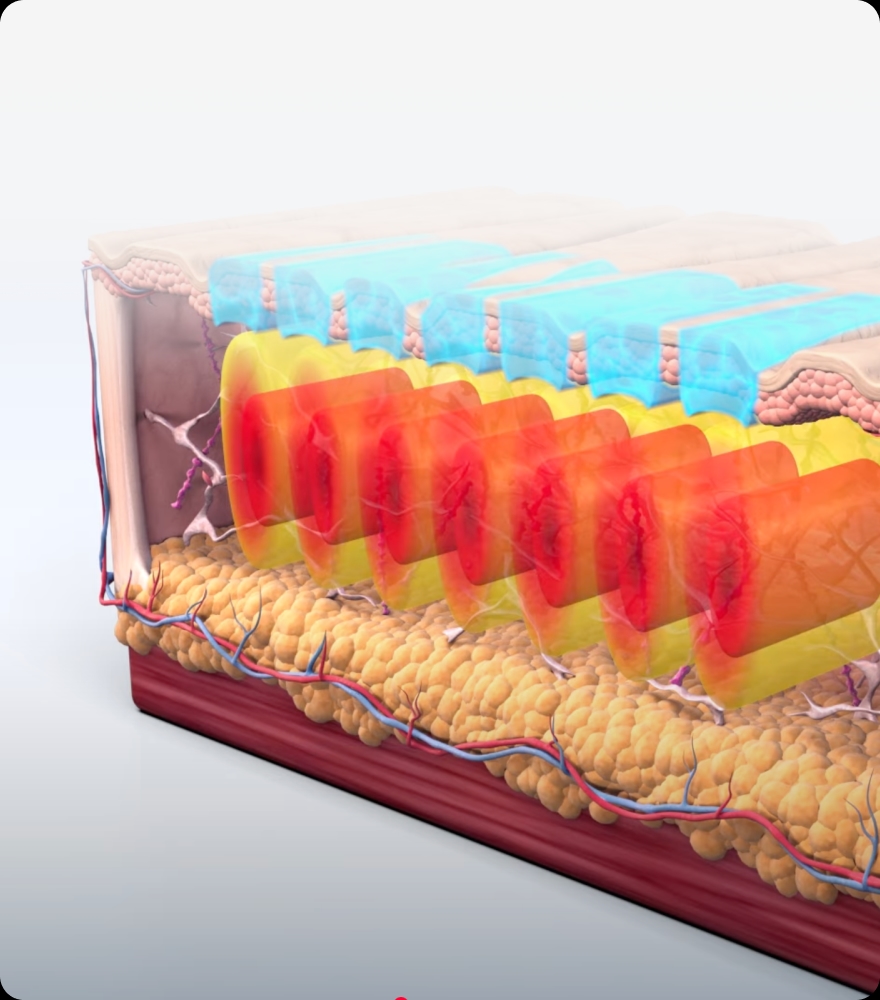 트리클 카드 배경