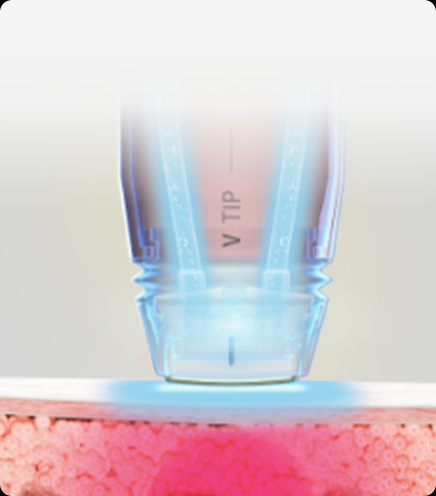 트리클 카드 배경