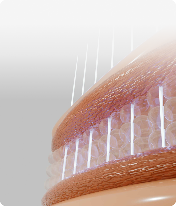 트리클 카드 배경