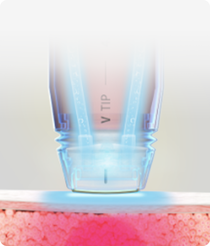 트리클 카드 배경